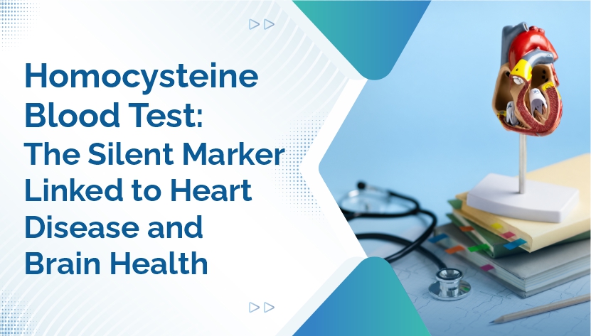Homocysteine Blood Test: The Silent Marker Linked to Heart Disease and Brain Health